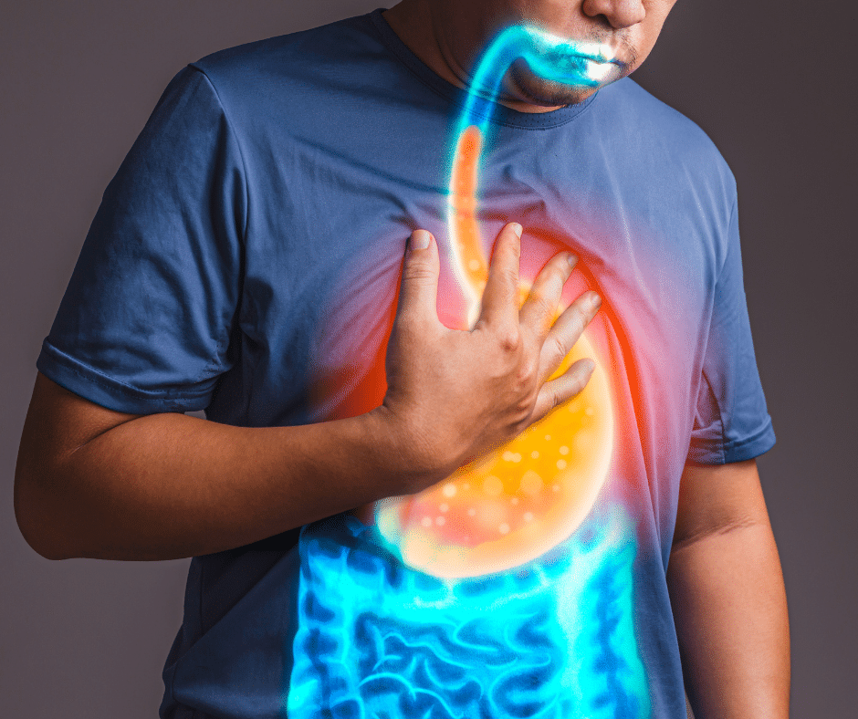 40% de la población mexicana tienen la enfermedad por reflujo gástrico